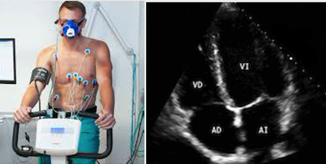 Ergoespirometria y Ecocardiograma