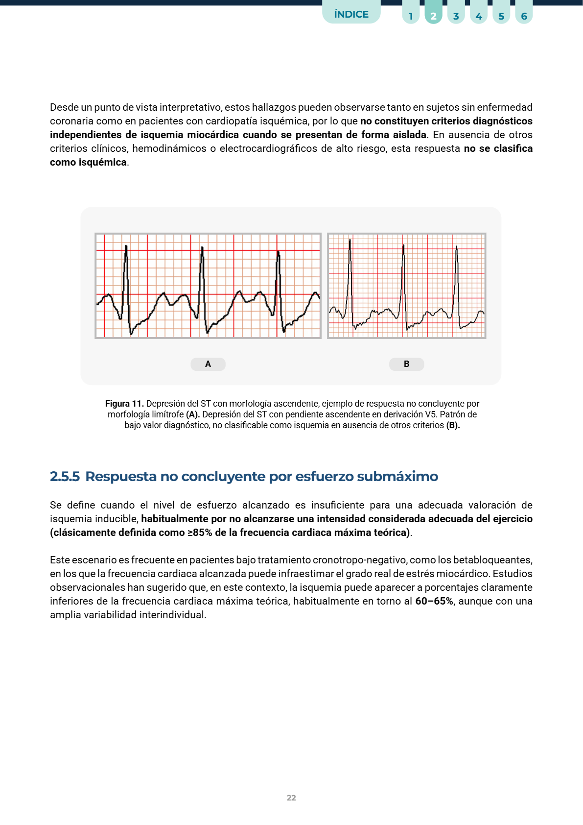 Casos reales de ECG